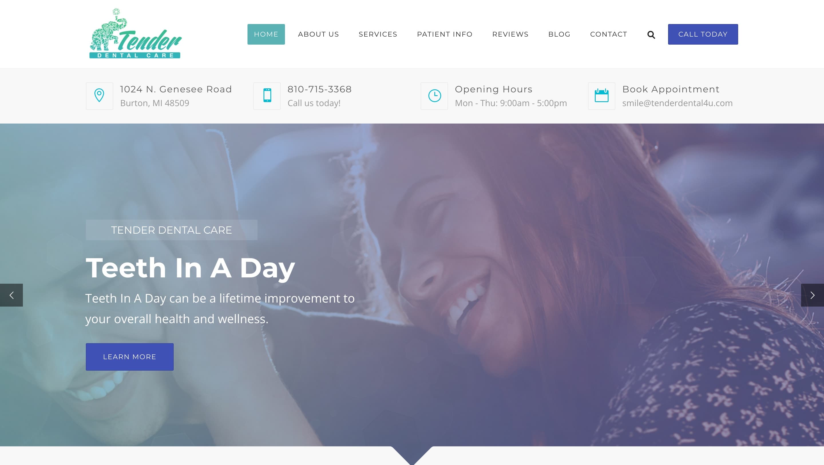 Tender Dental Care homepage hero highlighting the Teeth In A Day treatment